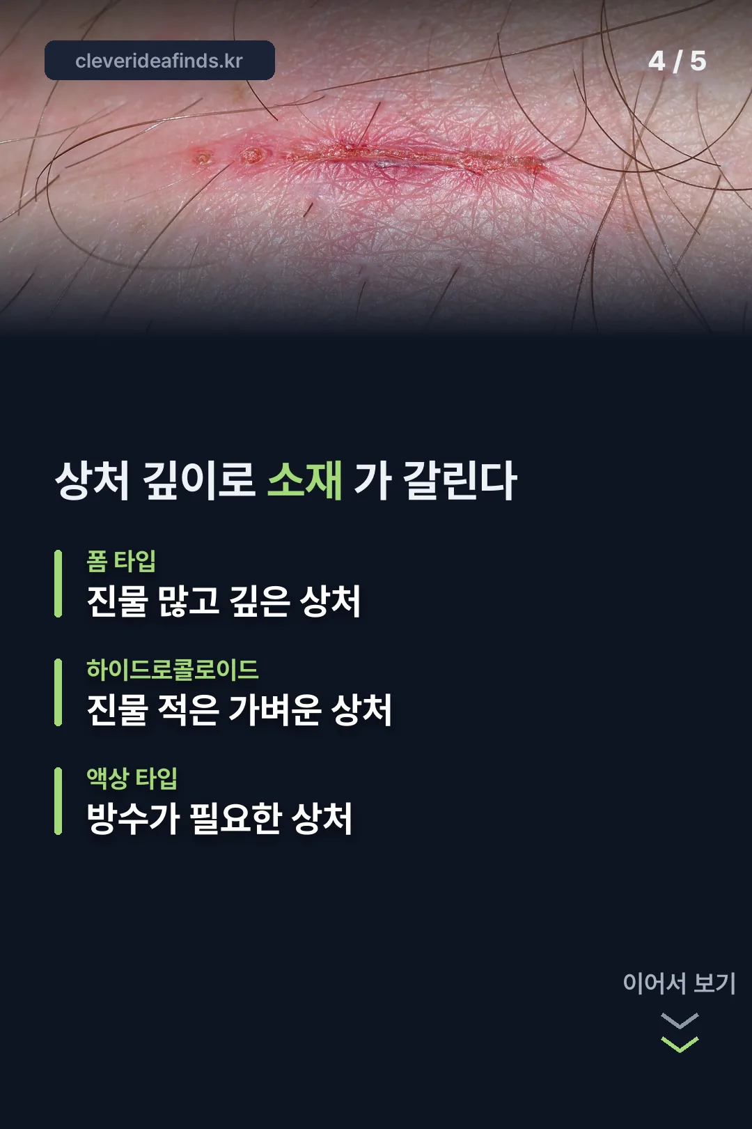 소재별 비교