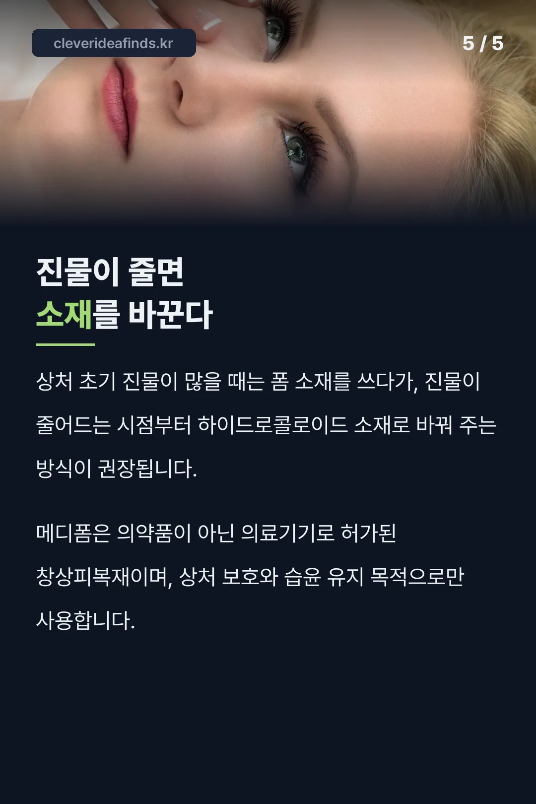 진물 변화에 따른 소재 전환
